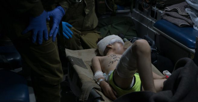 Schwer verletztes Kind, ein Opfer der Bombenangriffe in Syrien